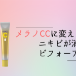 2ヶ月でニキビとさよなら！ビフォーアフター初公開